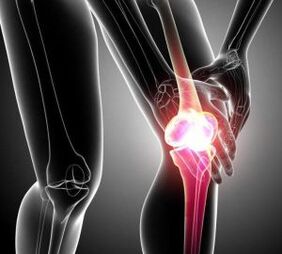 knee pain in arthritis and arthritis