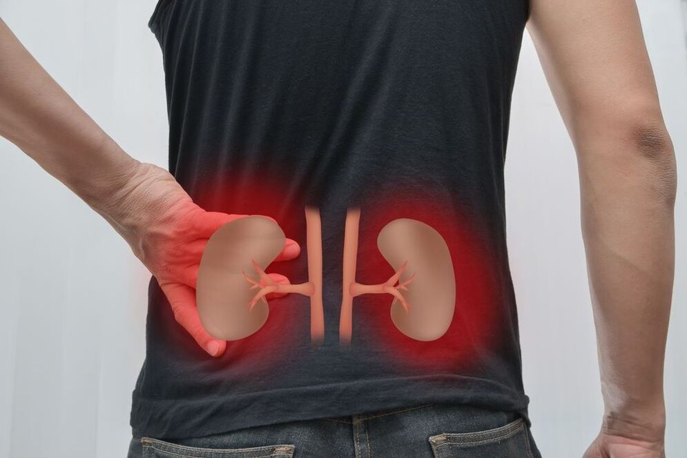 nephritis as a cause of back pain