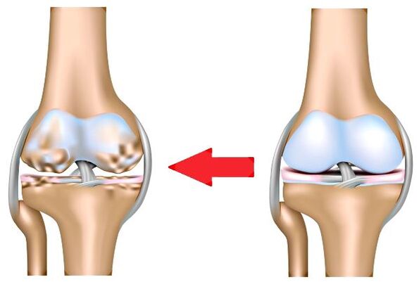 Healthy joint and joint