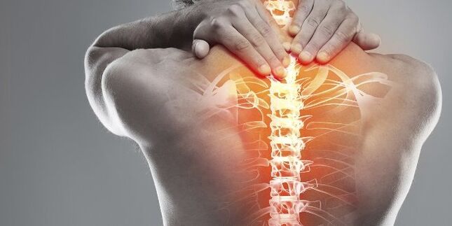 Medical options for cervical therapy