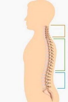 Lesion of osteochondrosis of different parts of the spine
