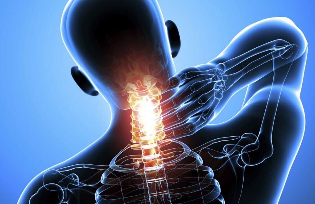 The cervical spine osteochondrosis