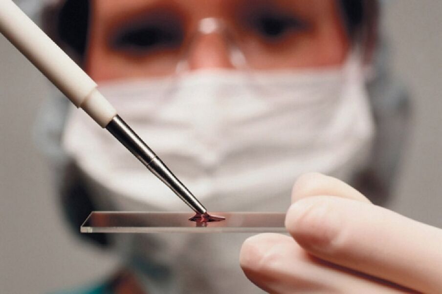 Arthritis is an inflammatory disease, its presence is detected by a blood test.