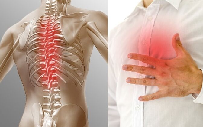 Thoracic osteochondrosis manifests itself in pain and tightness in the chest